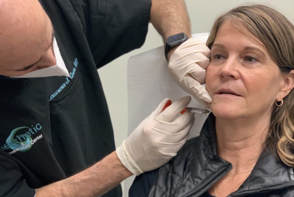 RHA Fillers: Facial Fillers Without the Frozen Face