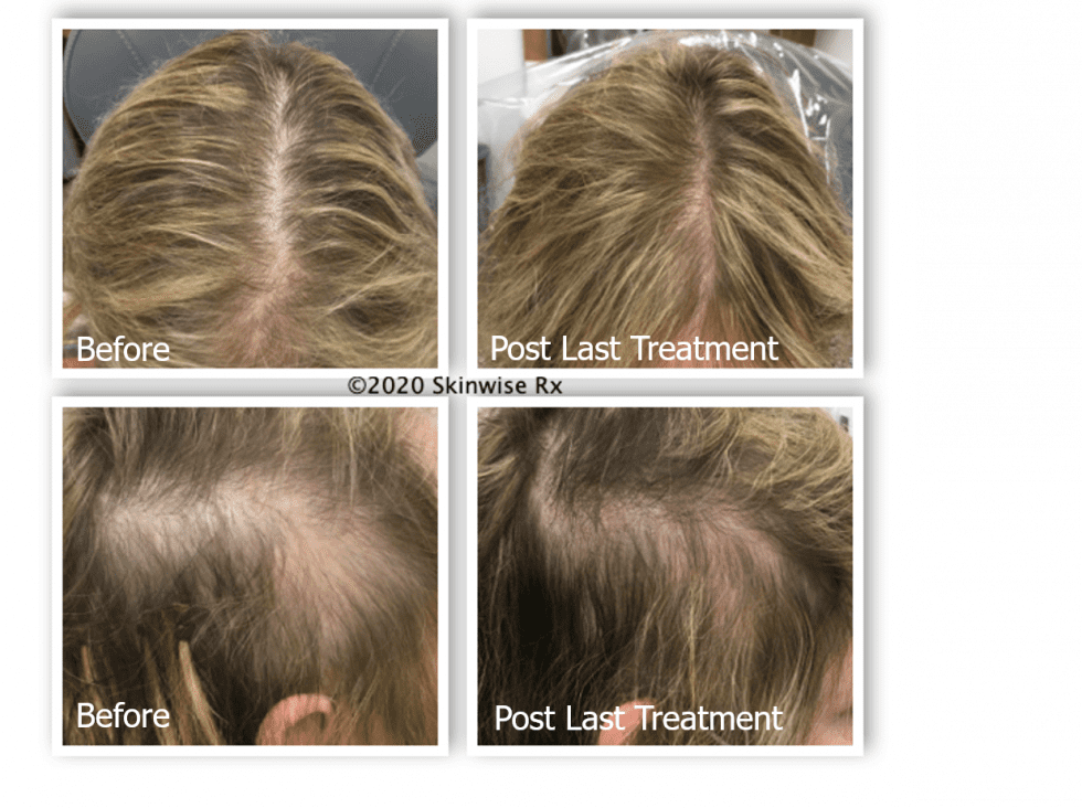Female Hair Loss Aesthetic & Dermatology Center