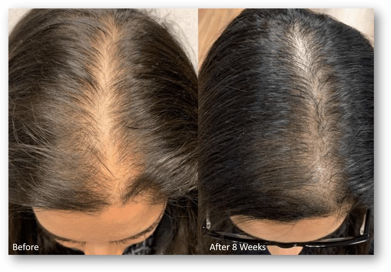 hair-loss-treatment