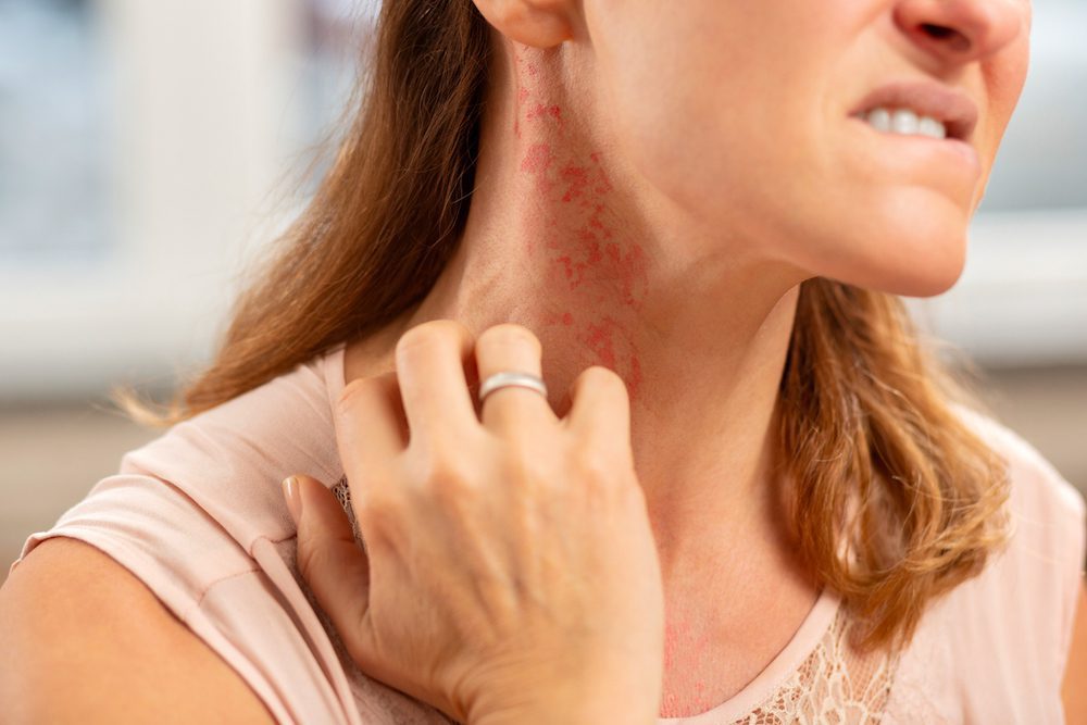 Allergic Reactions and Skin Rash Aesthetic & Dermatology Center