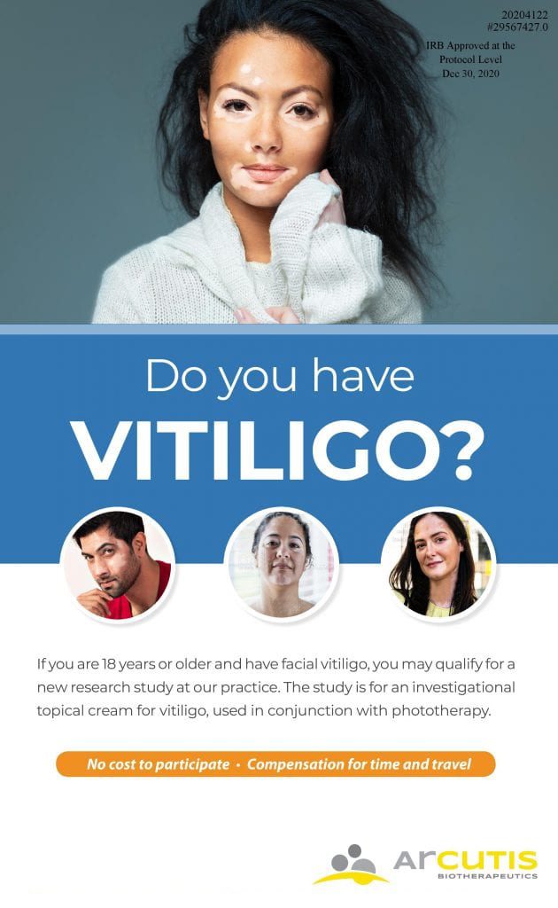 Vitiligo Poster Vitiligo Poster