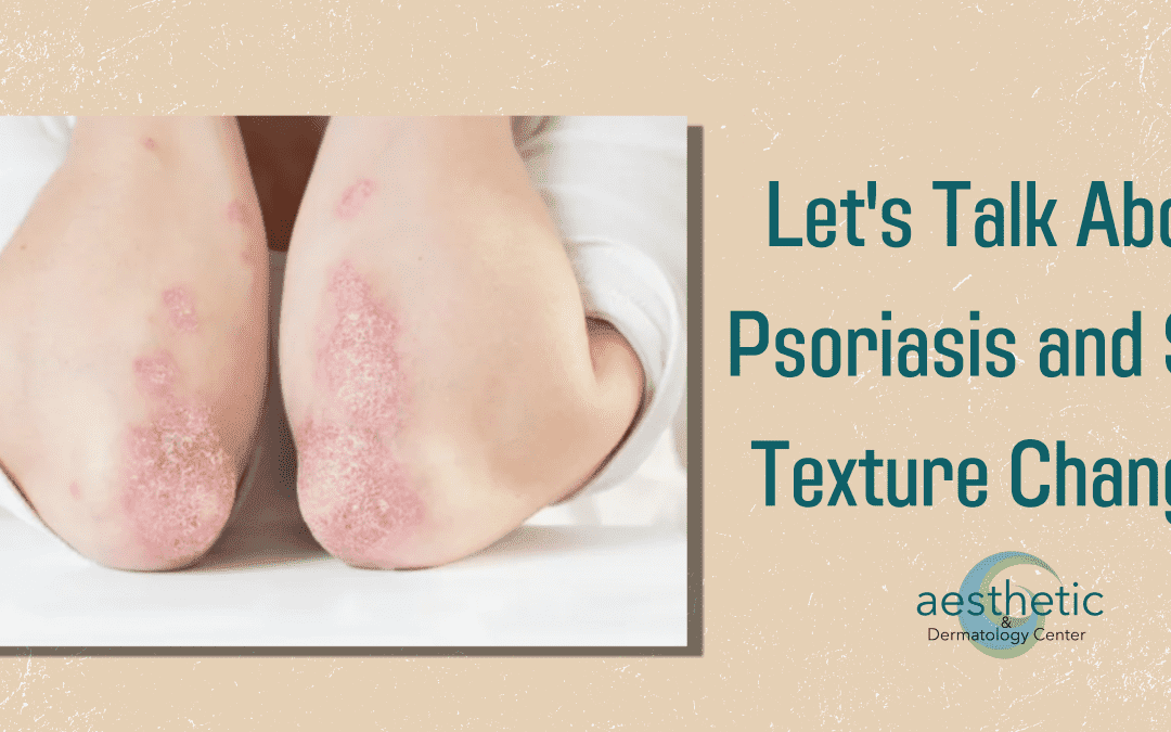Let’s Talk About Psoriasis and Skin Texture Changes